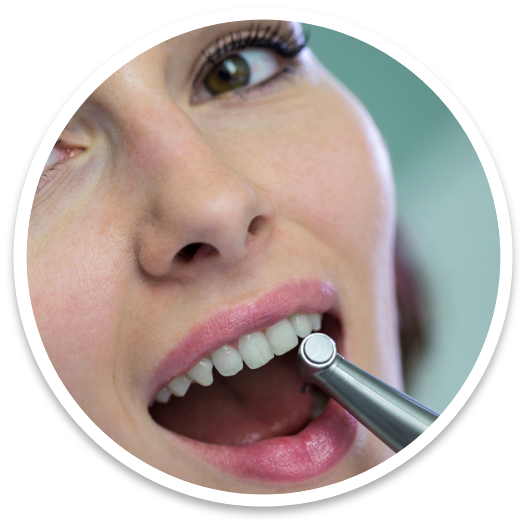 foto-sealants