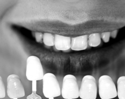 banner-restorative-dentistry Restorative dentistry
