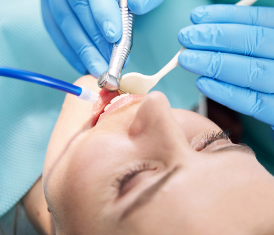 banner-root-canals